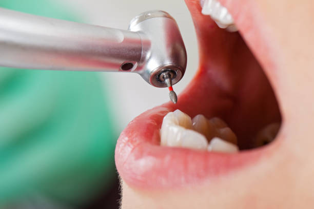 Best Emergency Denture Repair in Rockmart, GA